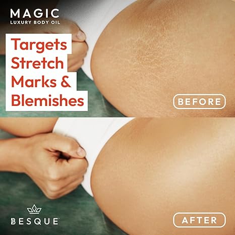 Besque Original Magic Body Oil, 3.4 FL OZ, After Shower Body Oil For Women, Hydrating Skin Care For Full Body That Plumps, Tightens, & Firms Skin With Natural Ingredients, Luxury Spa Gifts - Pack of 1