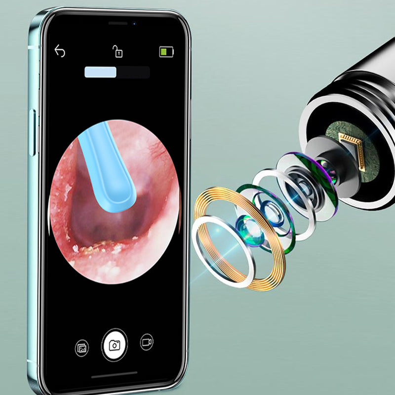 🏆Descuento por tiempo limitado👂Herramienta eléctrica visualizada para la eliminación de cerumen